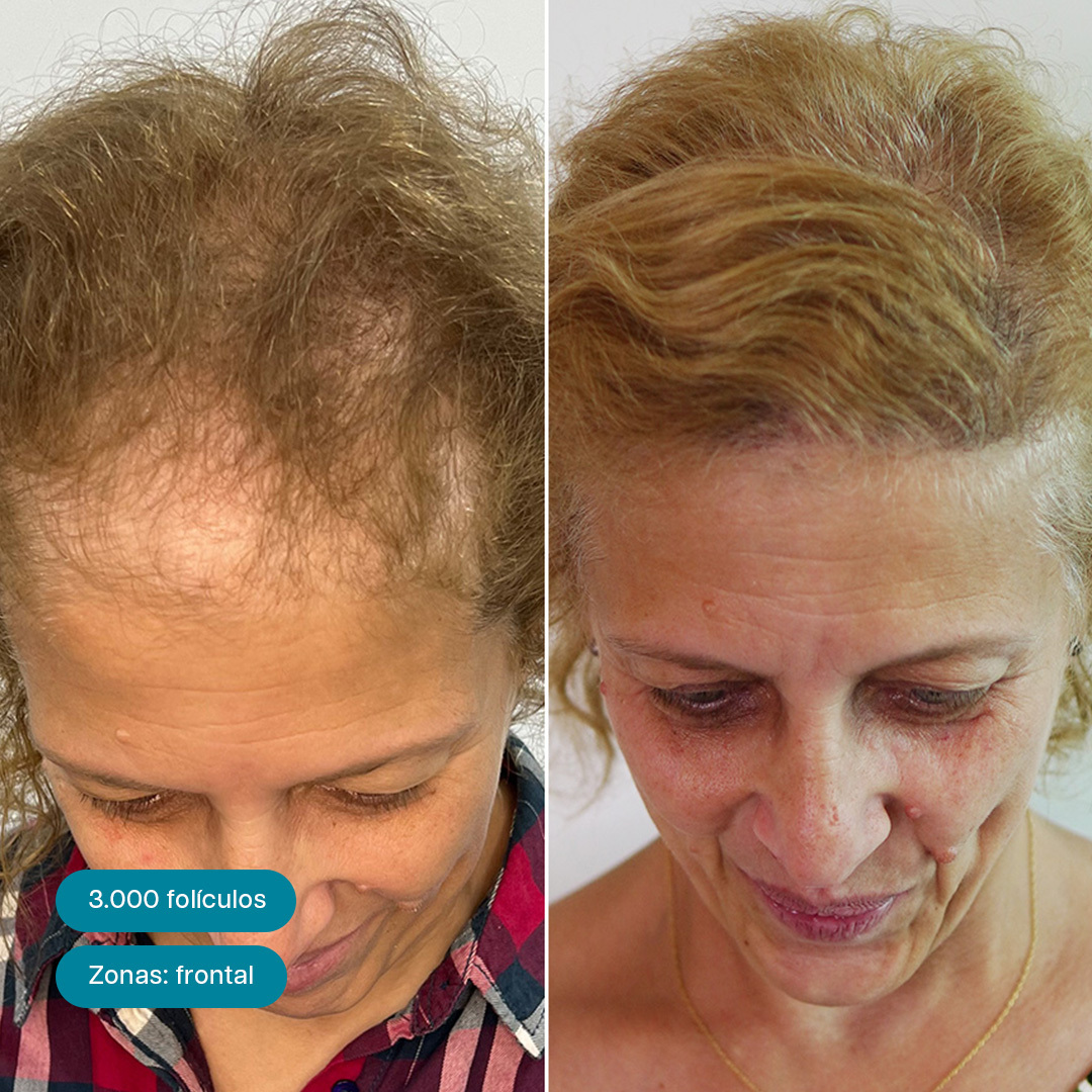 Antes e Depois 1